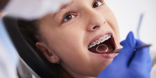 Girl with braces during a routine, dental examination